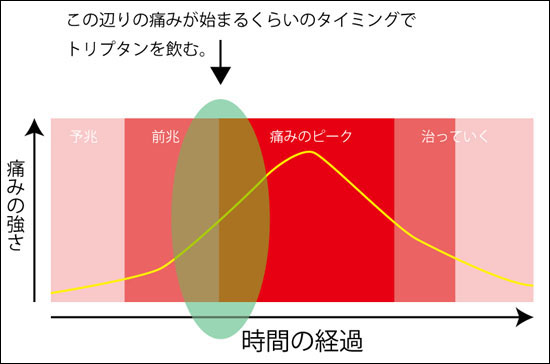 トリプタン系薬剤のイミグランを飲むタイミング